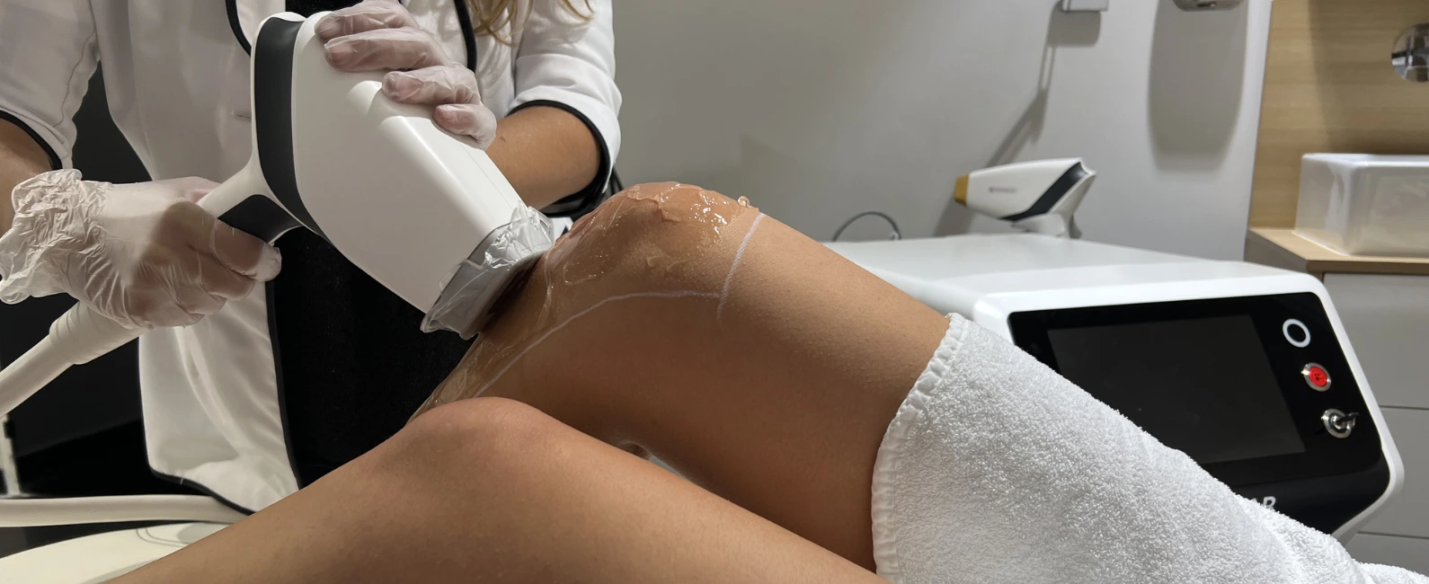 image-article-blog-laser-ou-ipl