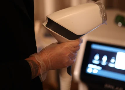 image-article-blog-tout-savoir-de-l-epilation-au-laser