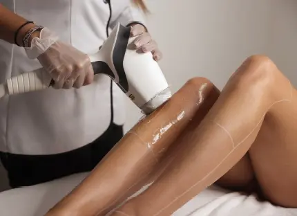 choisir-le-laser-parfait
