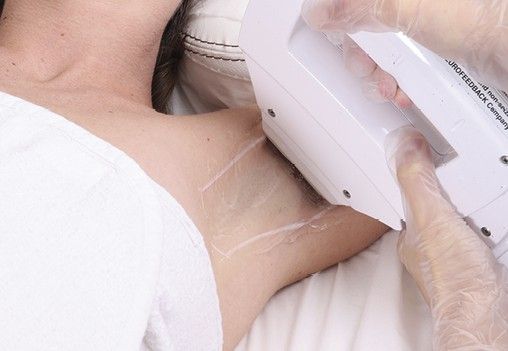 depiltech-article-deroulement-protocole-epilation-permanente-lumiere-pulsee