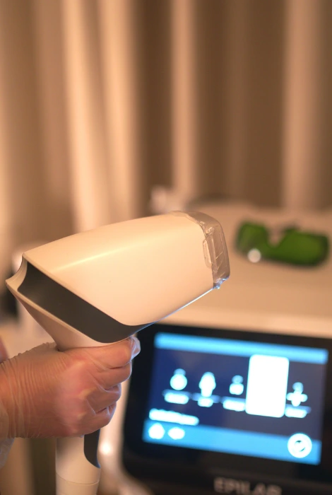 article-blog-115-epilation-laser